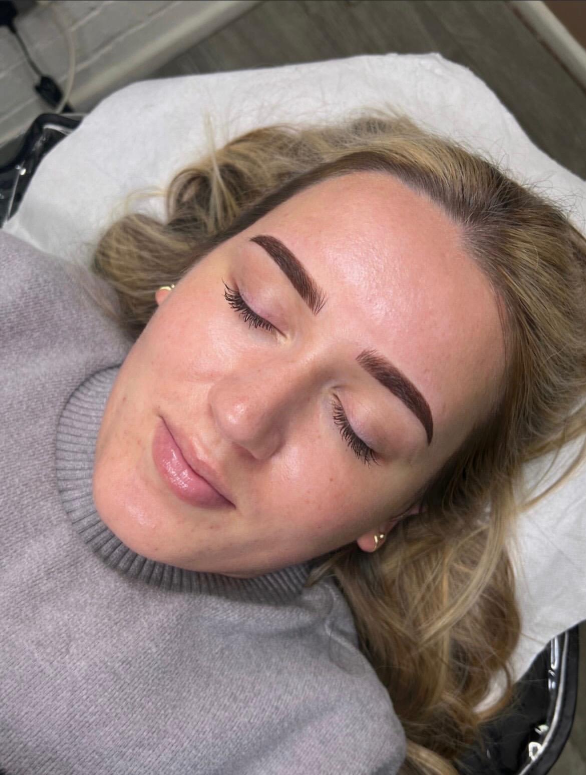 Brow result